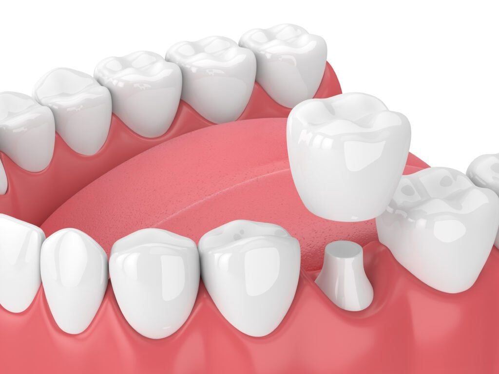 Union Hills Family Dental Care & Orthodontics -