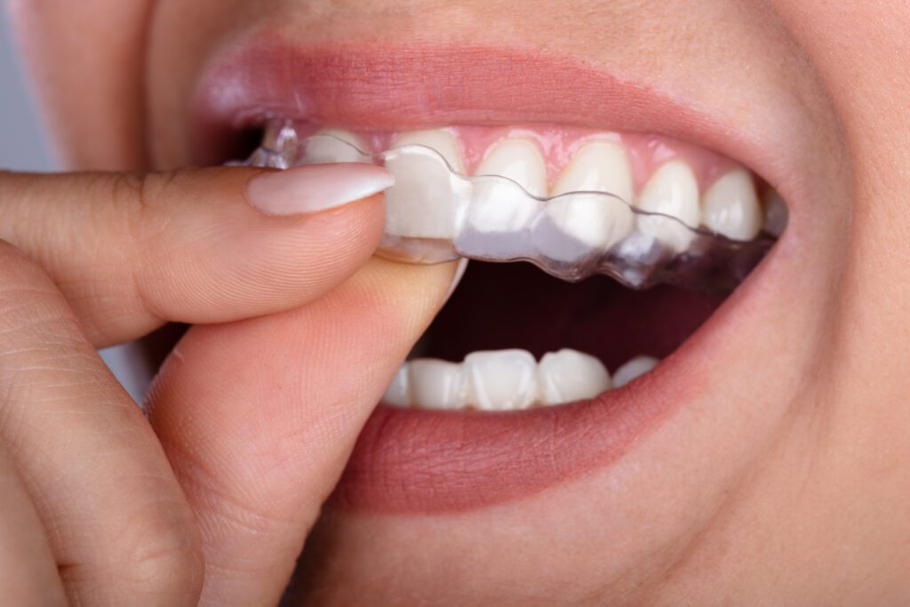 Union Hills Family Dental Care & Orthodontics -