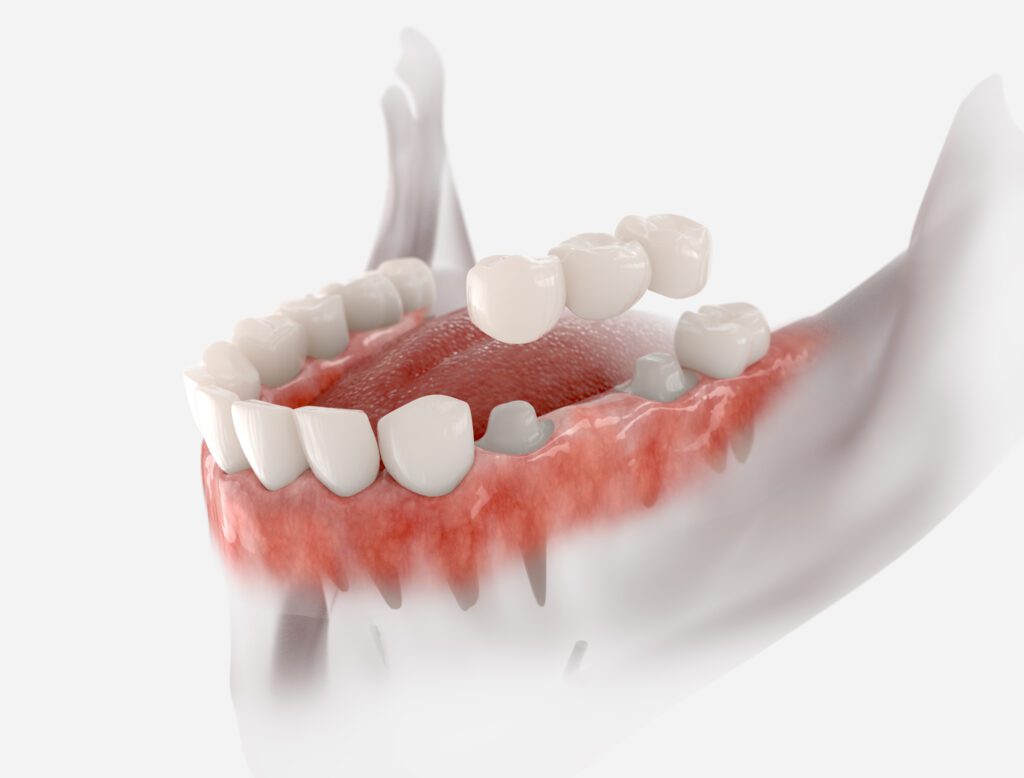 Union Hills Family Dental Care & Orthodontics -