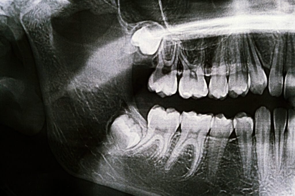 Union Hills Family Dental Care & Orthodontics -