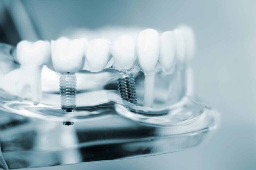Union Hills Family Dental Care & Orthodontics -
