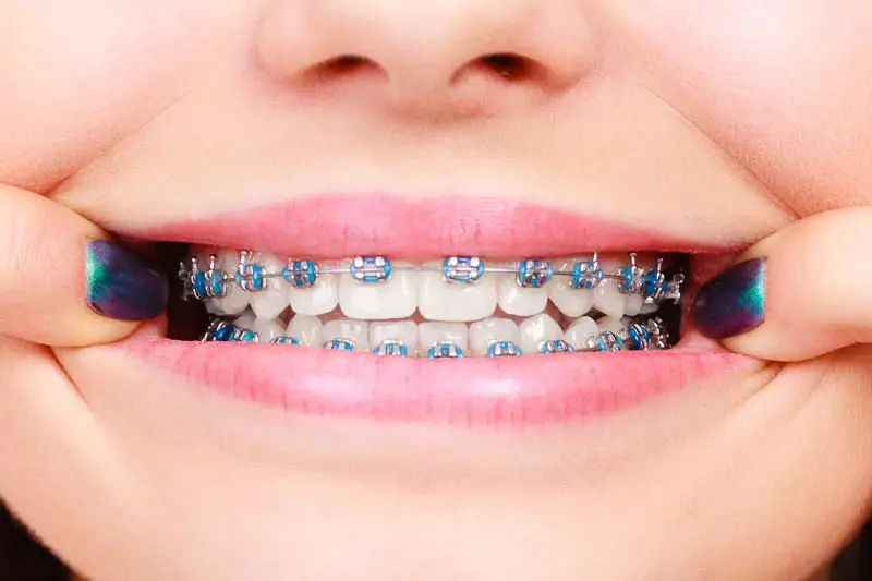 Union Hills Family Dental Care & Orthodontics -