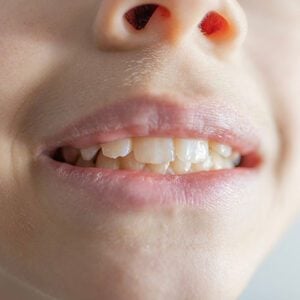Union Hills Family Dental Care & Orthodontics -